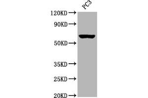Western Blot Positive WB detected in:PC3 whole cell lysate All lanes: Muscarinic Acetylcholine Receptor M3 antibody at 1:2000 Secondary Goat polyclonal to rabbit IgG at 1/50000 dilution Predicted band size: 67 kDa Observed band size: 67 kDa (Recombinant CHRM3 抗体)