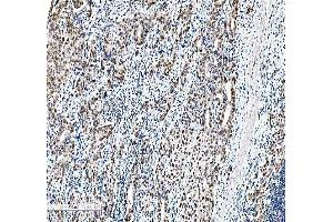 IHC analysis of CEBP Beta using anti-CEBP Beta antibody (ABIN3043809).