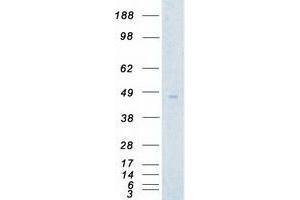 Western Blotting (WB) image for Aurora Kinase A (AURKA) (Transcript Variant 3) protein (Myc-DYKDDDDK Tag) (ABIN2715083)