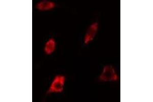 ABIN6278624 staining 293 cells by IF/ICC. (RAB35 抗体  (Internal Region))
