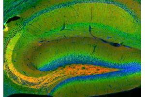 Indirect immunohistochemistry of a rat hippocampus section with rabbit anti-amphiphysin (cat. (Amphiphysin 抗体  (AA 2-15))