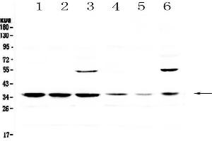 Western blot analysis of JunD using anti-JunD antibody . (JunD 抗体)