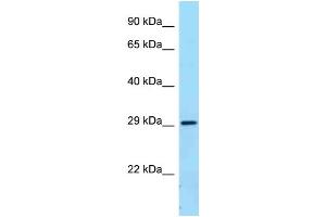 WB Suggested Anti-FCGR2B Antibody Titration: 1. (FCGR2B 抗体  (C-Term))