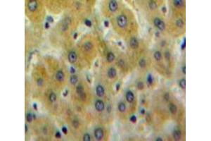 Used in DAB staining on fromalin fixed paraffin-embedded Liver tissue (PLEKHA1 抗体  (AA 92-346))