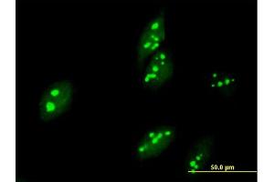 Immunofluorescence of purified MaxPab antibody to ABT1 on HeLa cell. (Activator of Basal Transcription 1 抗体  (AA 1-272))