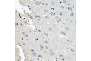 Immunohistochemistry of paraffin-embedded mouse brain using PKN1 antibody. (PKN1 抗体)