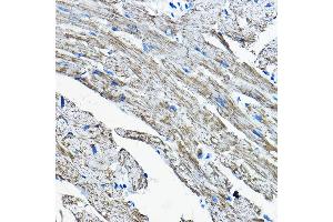 Immunohistochemistry of paraffin-embedded mouse heart using OGDHL Rabbit pAb (ABIN7269135) at dilution of 1:200 (40x lens). (OGDHL 抗体  (AA 1-110))