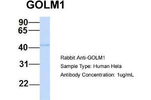 Host: Rabbit Target Name: GOLM1 Sample Type: Human Hela Antibody Dilution: 1. (GOLM1 抗体  (N-Term))