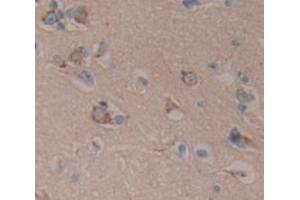 IHC-P analysis of Human Tissue, with DAB staining. (APLP1 抗体  (AA 62-202))