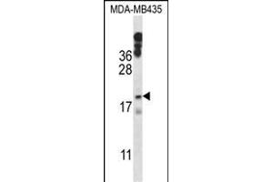 HIST1H1E Antibody (N-term) (ABIN657633 and ABIN2846629) western blot analysis in MDA-M cell line lysates (35 μg/lane). (HIST1H1E 抗体  (N-Term))