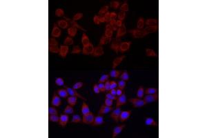 Immunofluorescence analysis of HeLa cells using SRP72 Rabbit pAb (ABIN6134166, ABIN6148452, ABIN7101299 and ABIN7101300) at dilution of 1:100 (40x lens). (SRP72 抗体)
