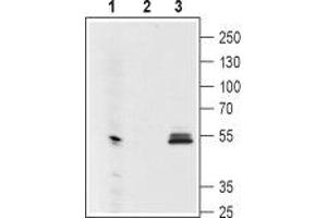Western blot analysis using Mouse Anti-GIRK1 (Kir3. (KCNJ3 抗体  (Extracellular Loop))