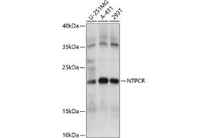 Western blot analysis of extracts of various cell lines, using NTPCR antibody (ABIN7269059) at 1:1000 dilution. (C1orf57 抗体  (AA 91-190))