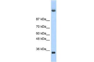 DAZ4 antibody used at 1 ug/ml to detect target protein. (DAZ4 抗体  (N-Term))