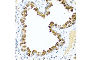Immunohistochemistry of paraffin-embedded mouse lung using NRG4 antibody (ABIN3016309, ABIN3016310, ABIN3016311 and ABIN6219713) at dilution of 1:100 (40x lens). (Neuregulin 4 抗体  (AA 1-115))