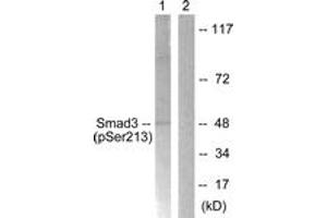 Western blot analysis of extracts from HT29 cells, using Smad3 (Phospho-Ser213) Antibody. (SMAD3 抗体  (pSer213))