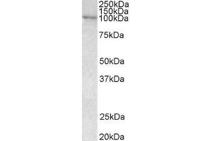 VAV3 抗体  (Internal Region)