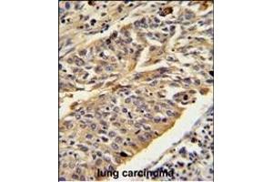 Immunohistochemistry (Paraffin-embedded Sections) (IHC (p)) image for anti-Cathepsin E (CTSE) (AA 157-187) antibody (ABIN390486)