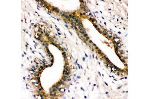 IHC analysis of SHP2/PTPN11 using anti-SHP2/PTPN11 antibody (ABIN3043912).