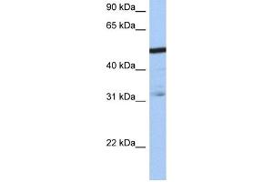 WB Suggested Anti-ZFAntibody Titration:  0. (ZFP14 抗体  (N-Term))