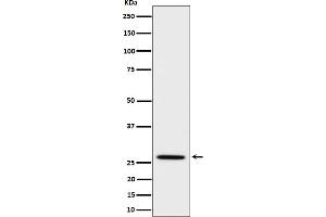 Western blot analysis of Adiponectin expression in mouse kidney cell lysate.
