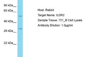 Host: Rabbit Target Name: ILDR2 Sample Tissue: Human 721_B Whole Cell Antibody Dilution: 1ug/ml (ILDR2 抗体  (C-Term))