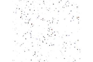 Immunocytochemistry (ICC) image for anti-Topo IIalpha (AA 650-700) antibody (ABIN7795795) (Recombinant Topo IIalpha (AA 650-700) 抗体)