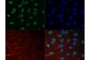 Fluorescence Microscopy (FM) image for anti-Histone 3 (H3) (H3K27me3) antibody (ABIN5706760)