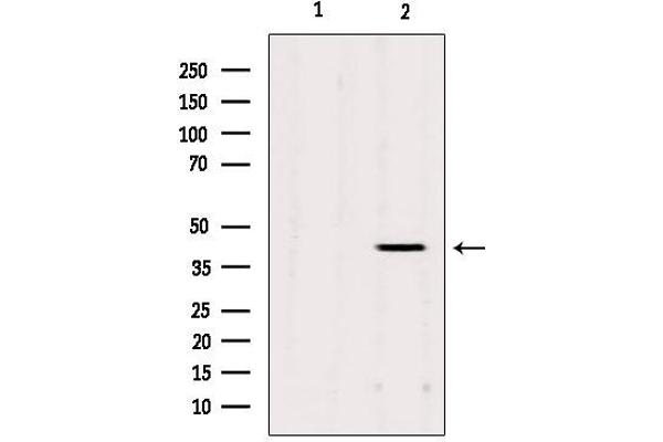 AGPAT3 抗体  (Internal Region)