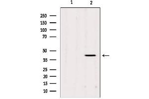 Western blot analysis of extracts from Mouse cancer, using AGPAT3 Antibody. (AGPAT3 抗体  (Internal Region))