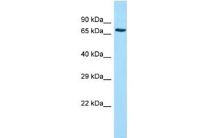 Host: Rabbit Target Name: ADCK2 Sample Type: Jurkat Whole Cell lysates Antibody Dilution: 1. (ADCK2 抗体  (Middle Region))