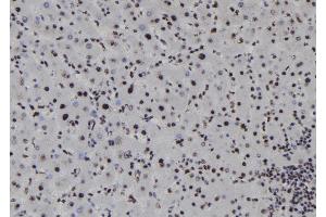 ABIN6278217 at 1/100 staining Human liver tissue by IHC-P. (SOX1 抗体  (Internal Region))
