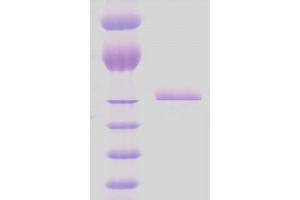 SDS-PAGE of 65 kDa M. (HSPD1 Protein (partial))