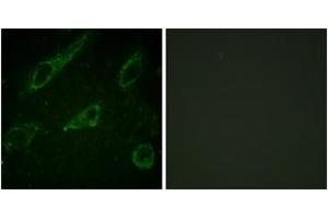 Immunofluorescence analysis of HeLa cells, using c-Abl (Phospho-Tyr245) Antibody. (ABL1 抗体  (pTyr245))