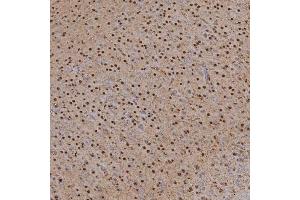 IHC analysis of SNRPA1 using anti-SNRPA1 antibody (ABIN7599131).