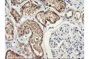 Immunohistochemical staining of paraffin-embedded Human Kidney tissue using anti-PDSS2 mouse monoclonal antibody. (PDSS2 抗体)