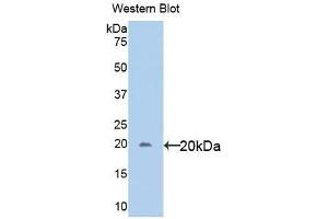 Detection of Recombinant gp130, Human using Polyclonal Antibody to Glycoprotein 130 (gp130) (CD130/gp130 抗体  (AA 392-566))