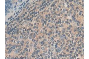 Detection of GDF10 in Human Stomach Tissue using Polyclonal Antibody to Growth Differentiation Factor 10 (GDF10) (GDF10 抗体  (AA 337-477))