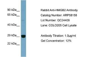 WB Suggested Anti-HMGB2  Antibody Titration: 0. (HMGB2 抗体  (Middle Region))