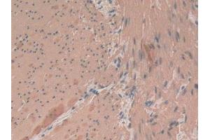 Immunohistochemistry (IHC) image for anti-Actin, alpha 2, Smooth Muscle, Aorta (ACTA2) (AA 167-377) antibody (ABIN7439306)