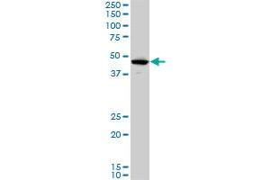 LHX5 monoclonal antibody (M05), clone 2B11. (LHX5 抗体  (AA 136-235))