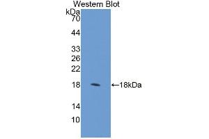 Western Blotting (WB) image for anti-Regulator of Chromosome Condensation (RCC1) and BTB (POZ) Domain Containing Protein 2 (RCBTB2) (AA 394-519) antibody (ABIN1870265)