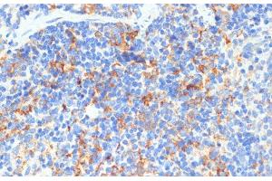 Immunohistochemistry (Paraffin-embedded Sections) (IHC (p)) image for anti-DEAD (Asp-Glu-Ala-Asp) Box Polypeptide 3, X-Linked (DDX3X) antibody (ABIN7261584)