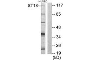 Western blot analysis of extracts from HuvEc cells, using ZNF387 Antibody. (ST18 抗体  (AA 41-90))
