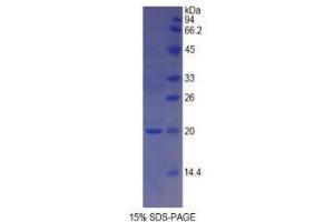 SDS-PAGE analysis of Rat GDF1 Protein. (GDF1 蛋白)