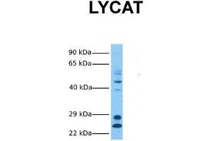 Host:  Rabbit  Target Name:  LYCAT  Sample Tissue:  Human Fetal Liver  Antibody Dilution:  1. (LCLAT1 抗体  (Middle Region))