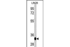 Western blot analysis of LIN28 recombinant protein by anti-LIN28A Monoclonal Antibody (ABIN387790 and ABIN2838026). (LIN28A 抗体)