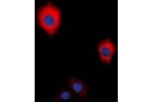 Immunofluorescent analysis of ZAP70 staining in HeLa cells. (ZAP70 抗体  (C-Term))