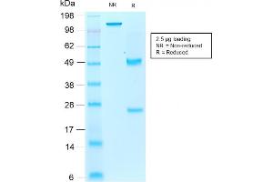 SDS-PAGE Analysis Purified AIF1 / Iba1 Mouse Recombinant Monoclonal Antibody (rAIF1/1909). (Recombinant Iba1 抗体  (AA 1-146))