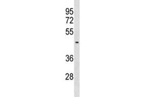 SUV39H2 antibody western blot analysis in MDA-MB453 lysate. (SUV39H2 抗体  (AA 367-395))
